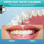 Portable Electric Dental Irrigator