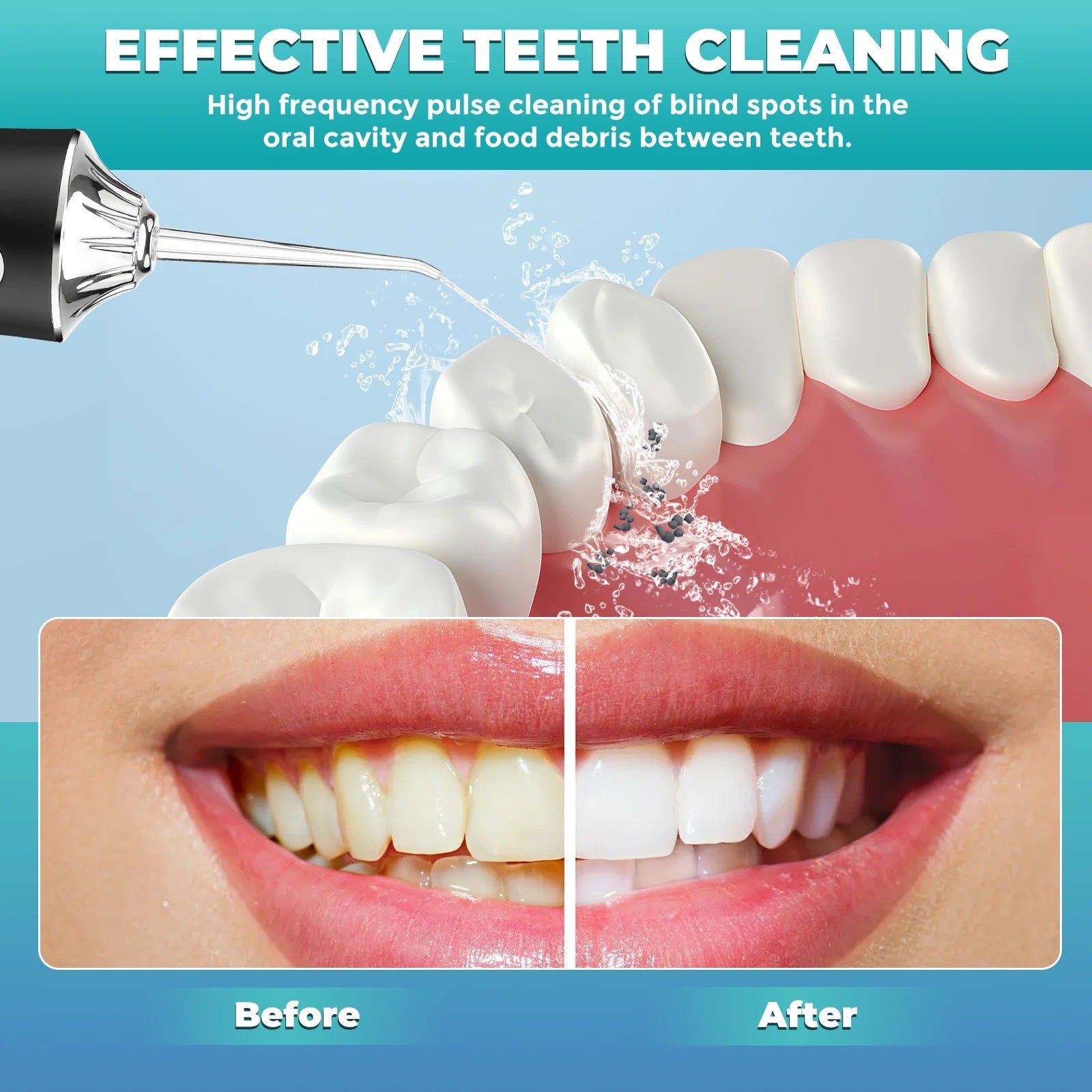 Portable Electric Dental Irrigator